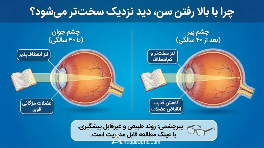 چرا با بالا رفتن سن، دید نزدیک سختتر میشود؟