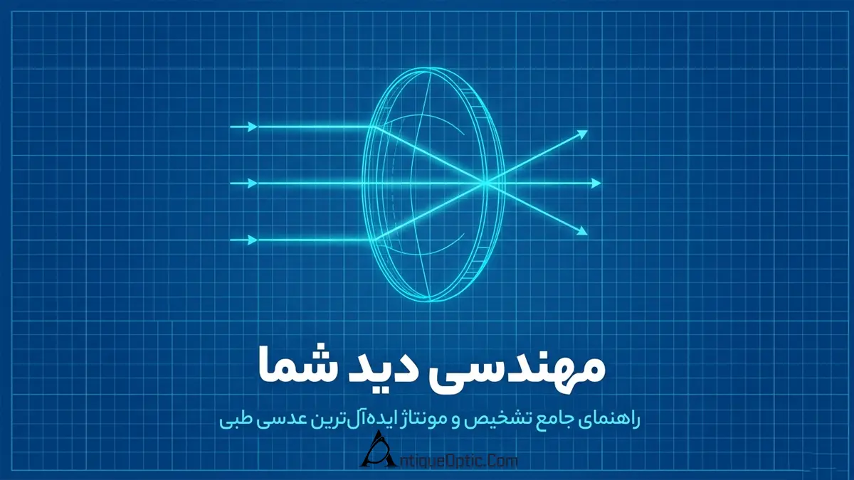 راهنمای جامع انواع عدسی طبی؛ کدام عدسی برای کدام نمره چشم مناسب است؟